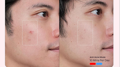 Red Light Therapy Mask